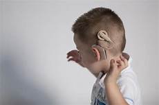 Cochlear Implant Program