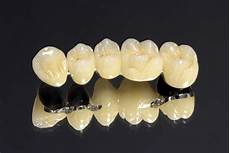 Dental Implant Material