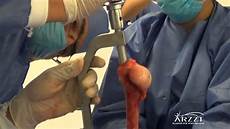 Orthopedics Implants