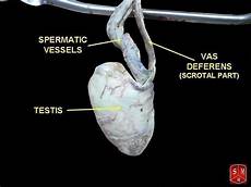 Preimplantation Genetic